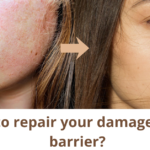 How to repair a damaged skin barrier (The Ultimate Step-by-step Guide for acne prone skin)